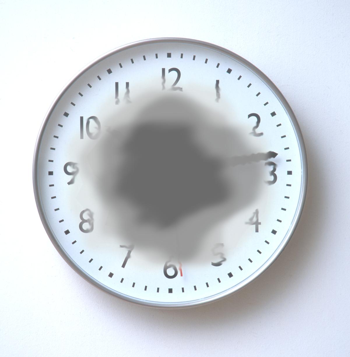 Macular Degeneration Vision Loss