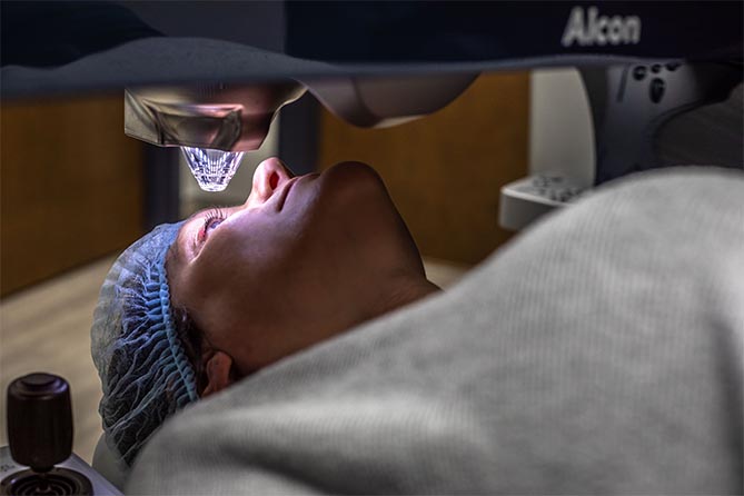 WaveLight® EX500 Excimer Laser Treatment