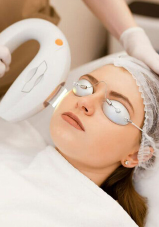 Woman undergoing IPL laser treatment